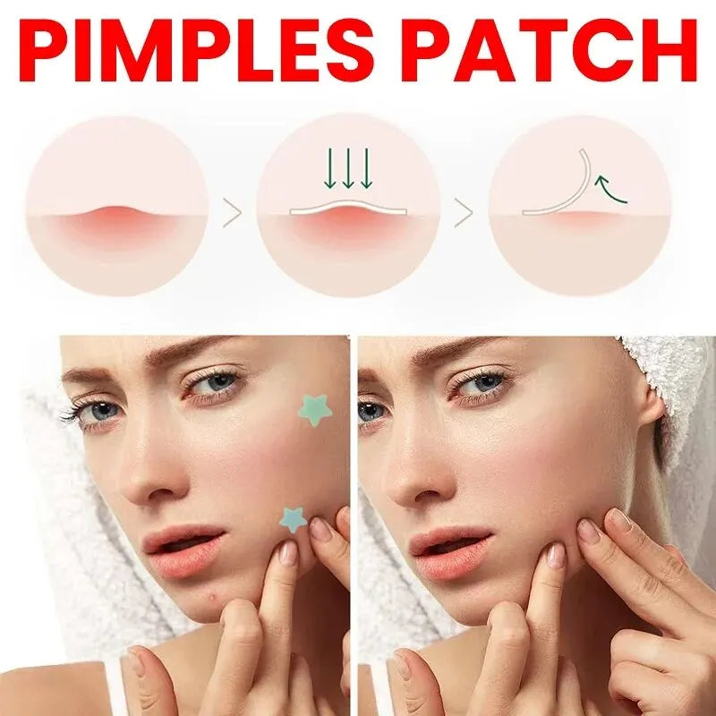 Facial Skin Care Repair Acne Patch for Pimple Marks Fade Blemishes Short Eye Catching Description for Face Skin Care Tools