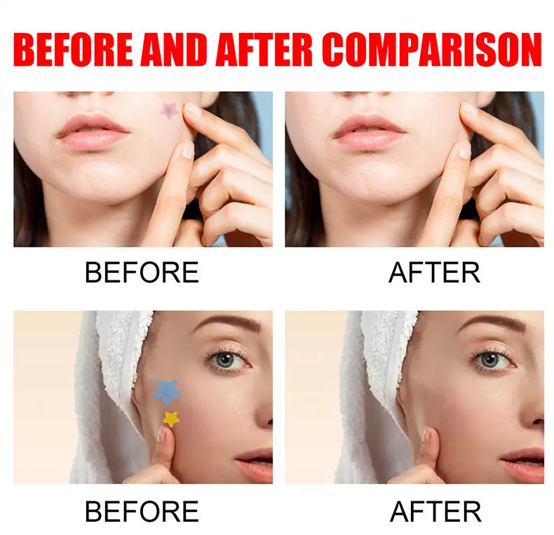 Facial Skin Care Repair Acne Patch for Pimple Marks Fade Blemishes Short Eye Catching Description for Face Skin Care Tools