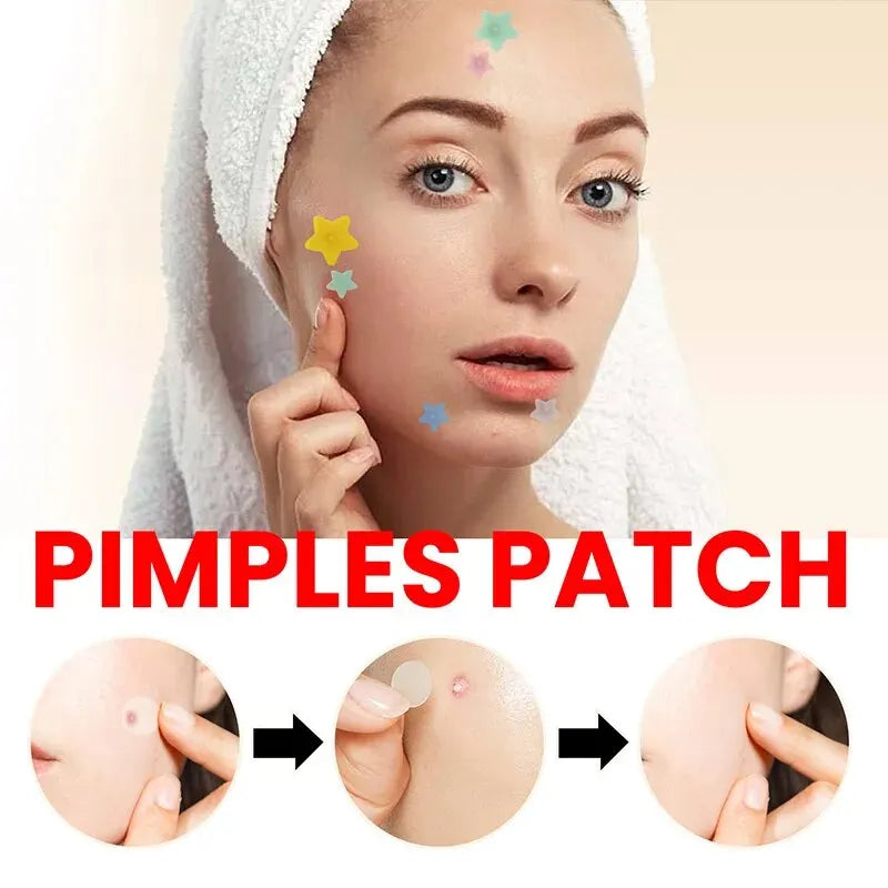 Facial Skin Care Repair Acne Patch for Pimple Marks Fade Blemishes Short Eye Catching Description for Face Skin Care Tools